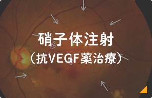 硝子体注射（抗VEGF薬治療）