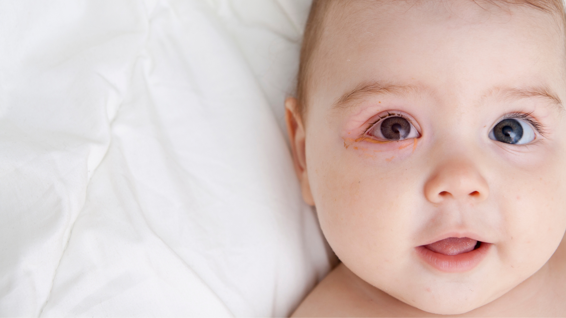 子どもの目は誕生してから成長します