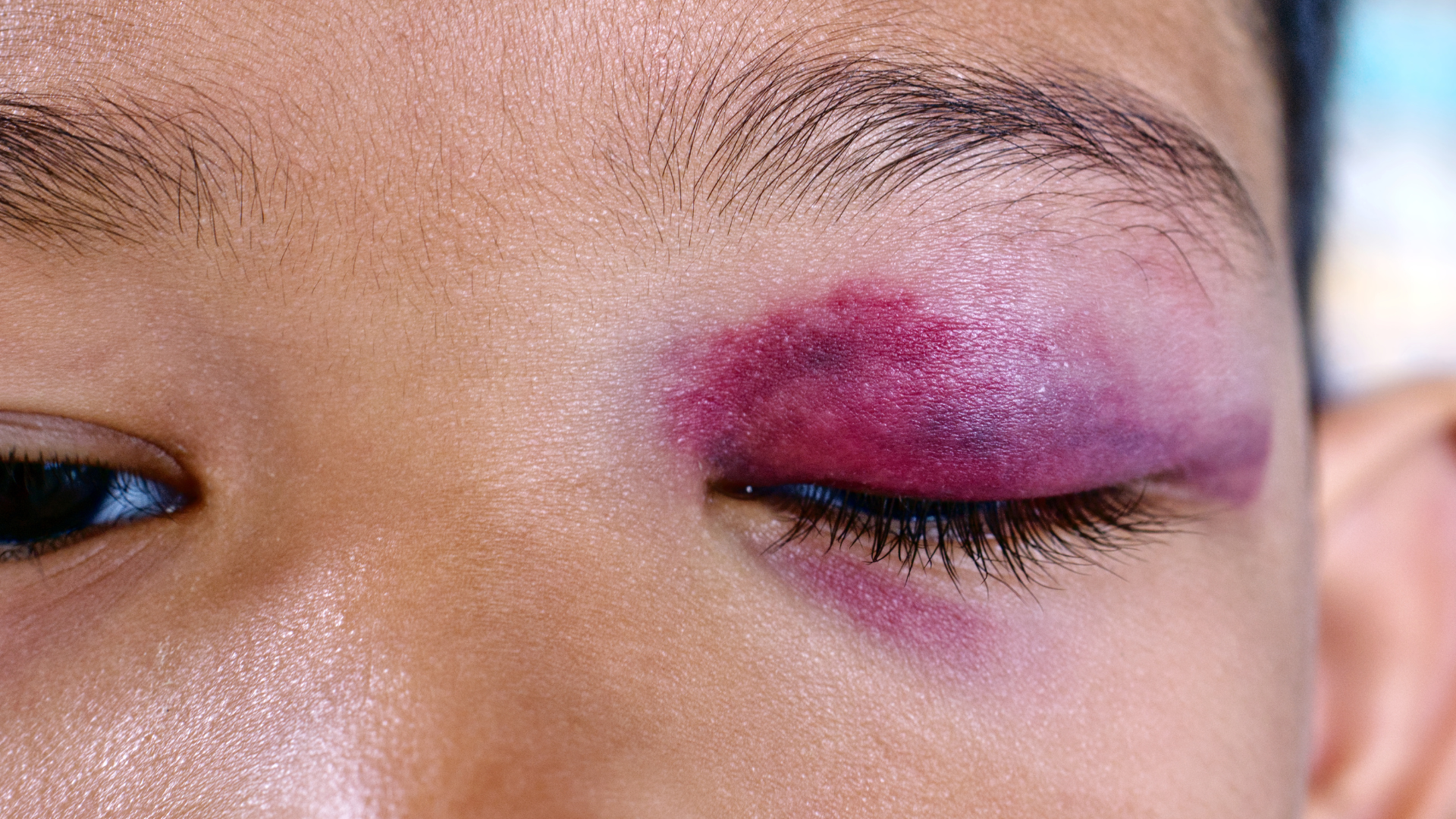 子どもの目は誕生してから成長します